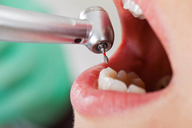 Best Emergency Treatment for Oral Infections in Third Lake, IL